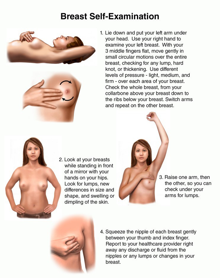 Breast Lump Zanaposh